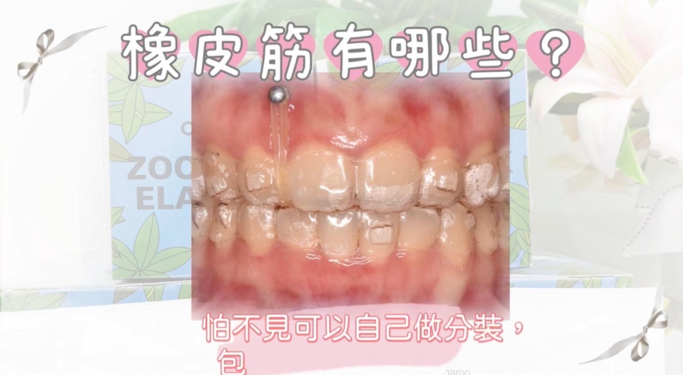20250222131850O5wf