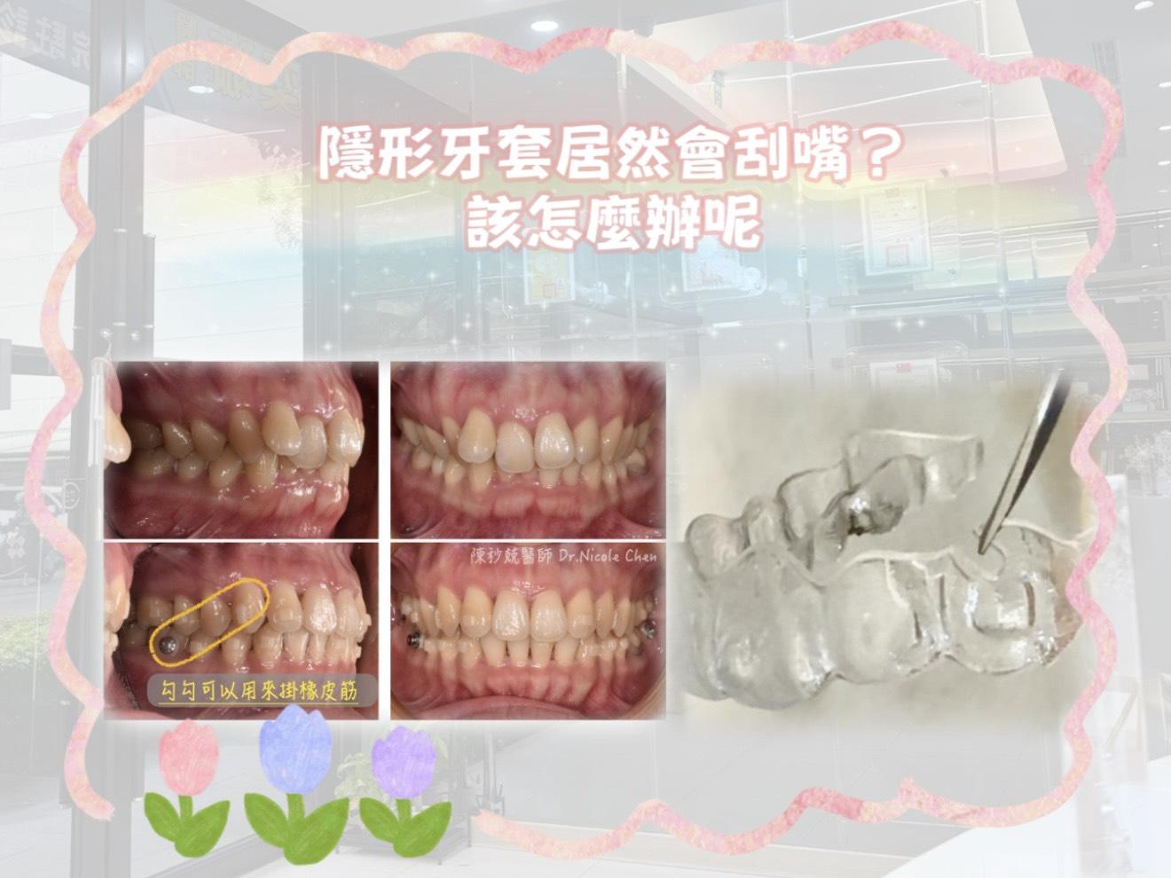 20250321091504E8zc