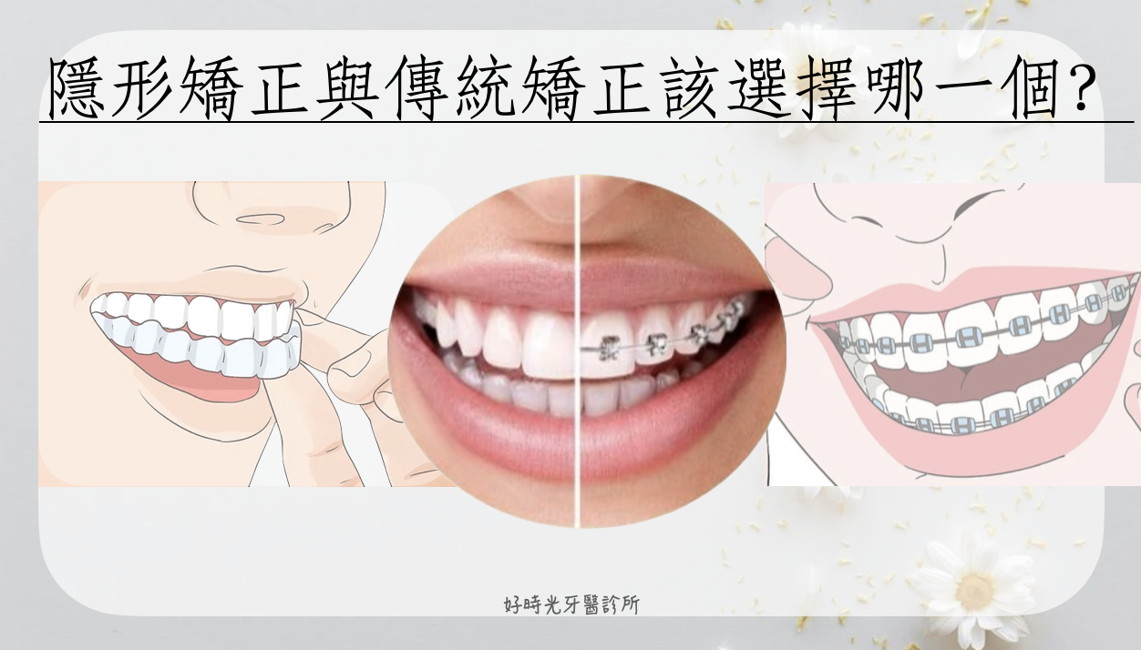 202507241719367dZt