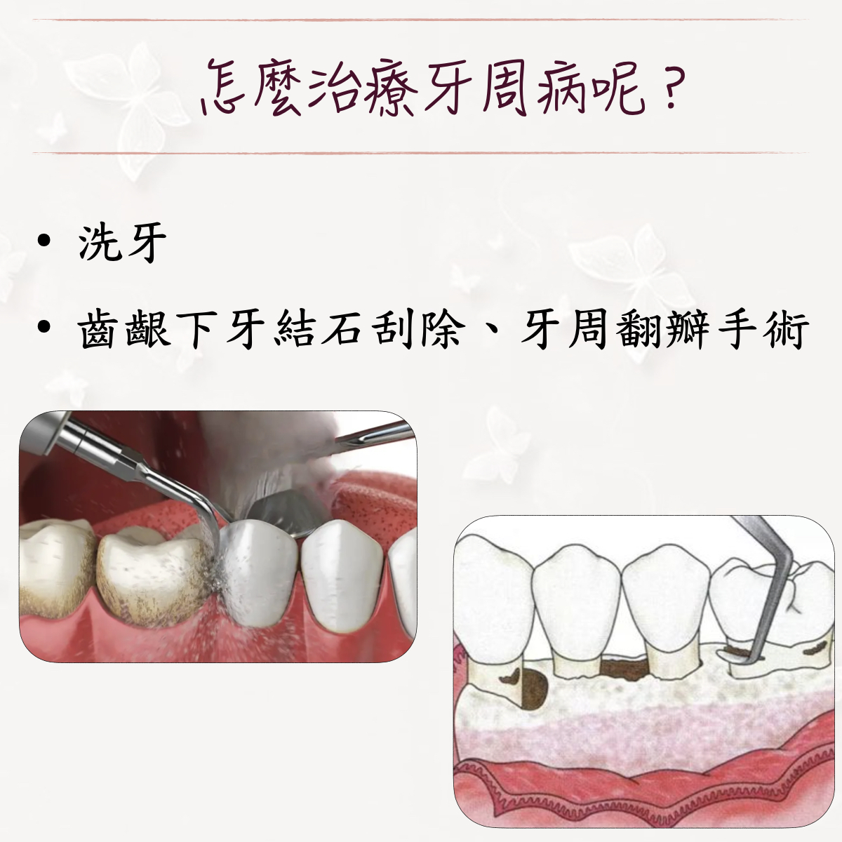 20250807155749vKSy